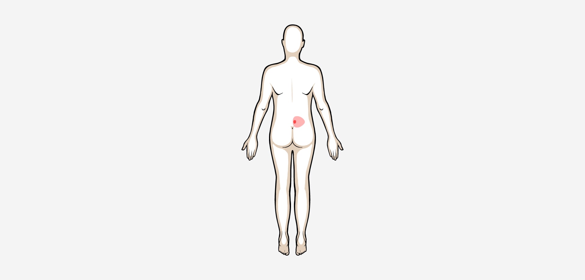 Dolor unilateral localizado